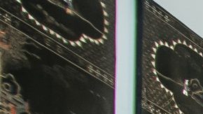 Photo: Unsplash/@chastityco