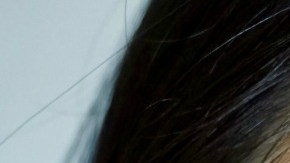 I Tried Rosehip Oil For a Week To Cure My Rosacea Hiplatina