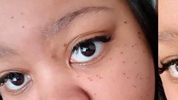 Photo: Instagram/dermologysandton